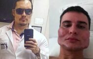 Médico é acusado de deformar rostos de pelo menos 30 pacientes