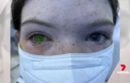 Doença deixa os ‘olhos verdes’ e assusta australianos