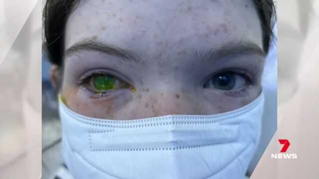 Doença deixa os ‘olhos verdes’ e assusta australianos