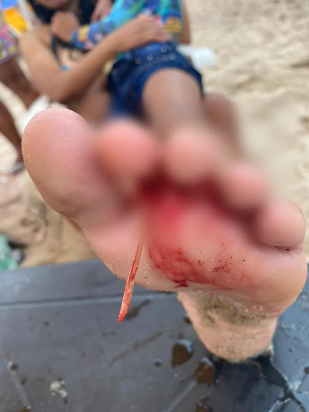 Criança tem pé furado por ferrão de arraia na praia de Pajuçara, em Maceió