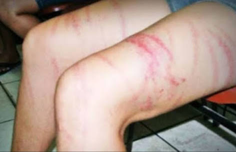 Mulher marca encontro com homem casado e apanha de chicote da esposa dele; VEJA VÍDEO