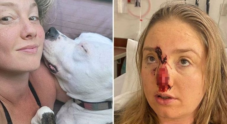 Pit bull se assusta com o brilho nos dentes e arranca nariz de mulher