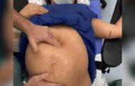 Vídeo de bebê sendo virado na barriga antes do parto impressiona internautas; veja