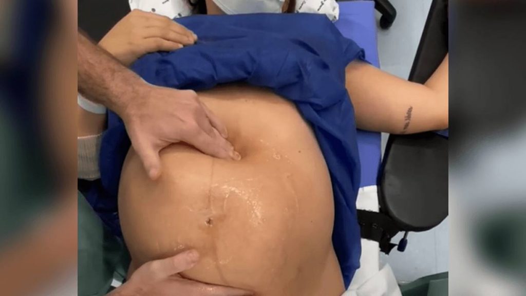 Vídeo de bebê sendo virado na barriga antes do parto impressiona internautas; veja