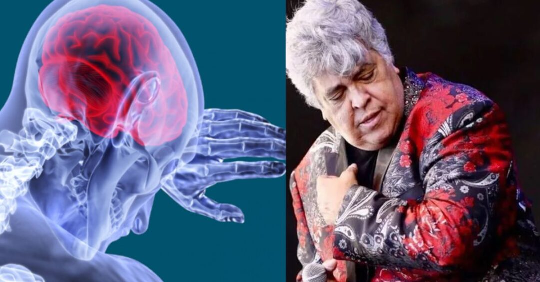 AVC: Causas e sintomas do ‘derrame cerebral’ que acometeu Sidney Magal
