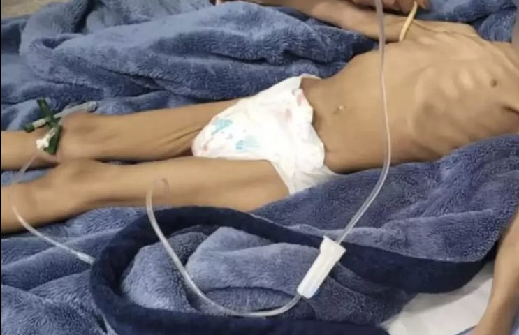 Menina de 3 anos fica 40 dias sem comer e pai é preso