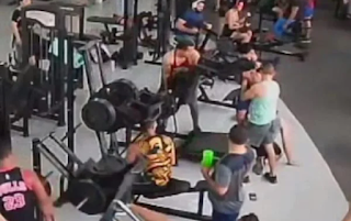 Raio-x mostra coluna de homem atingido por aparelho de academia