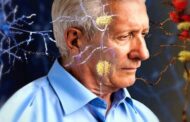 6 Sintomas de Alzheimer que as pessoas não conhecem: ‘Você deve ficar atento’