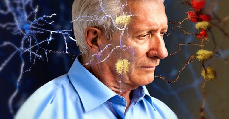 6 Sintomas de Alzheimer que as pessoas não conhecem: ‘Você deve ficar atento’