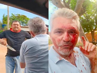 Jornalista sofre tentativa de assassinato por vereador do PT, enquanto cobria pauta sobre irregularidades