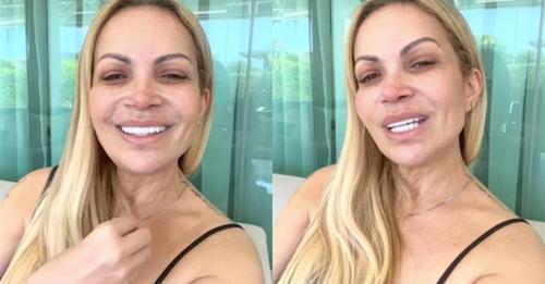 Solange Almeida desabafa sobre tratamento após vício em cigarros eletrônicos