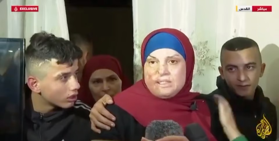 Terrorista condenada por explodir botijão de gás em carro quer exigir de Israel cirurgia plástica estética