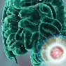Conheça os alimentos que se deve evitar para reduzir risco de câncer do intestino
