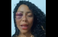 Mulher grava vídeo com olho roxo e denuncia namorado por agressão: 'Marcado na minha alma'