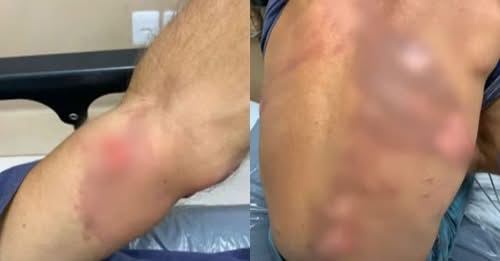 Homem é preso por torturar funcionário, obrigado a decepar o próprio dedo
