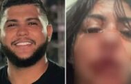 Absurdo: cantor de forró chora após agredir a namorada com um soco e deixá-la sem os dentes
