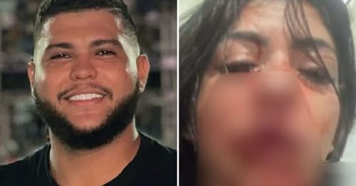 Absurdo: cantor de forró chora após agredir a namorada com um soco e deixá-la sem os dentes
