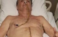 Bolsonaro segue sem movimentos intestinais há duas semanas e permanece na UTI