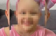 Criança de 9 anos descobriu câncer ao fazer dança no TikTok; entenda