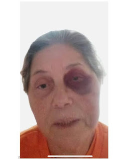 BRASIL: IDOSA CONDENADA PELO 8 DE JANEIRO É ESPANCADA NA CADEIA